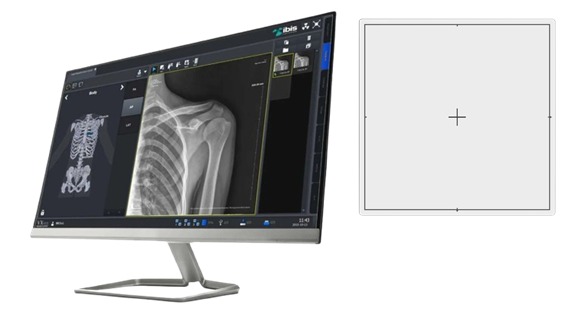 Digital X-Ray System (Flat Pannel Ditector-FPD)